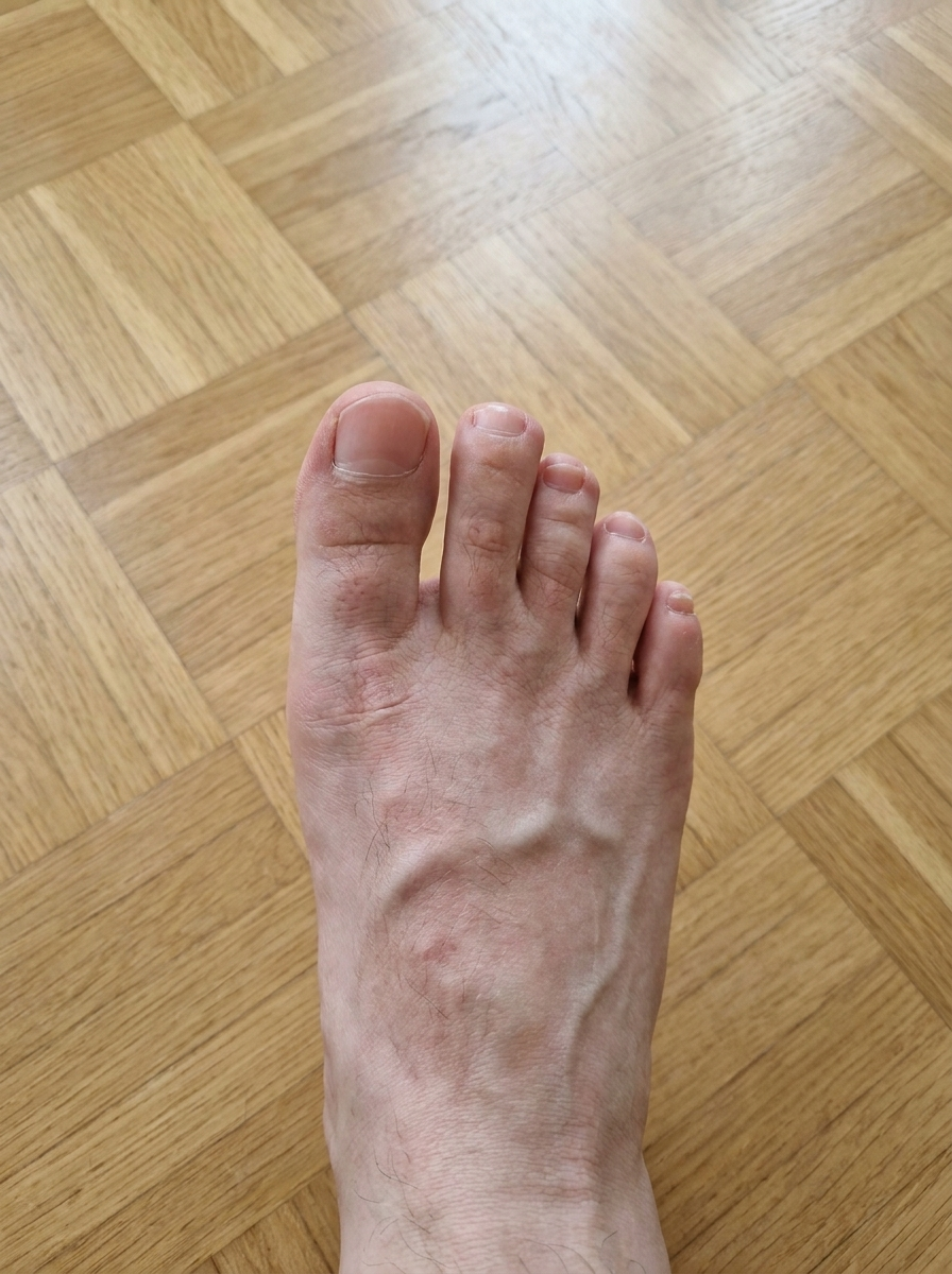 Après